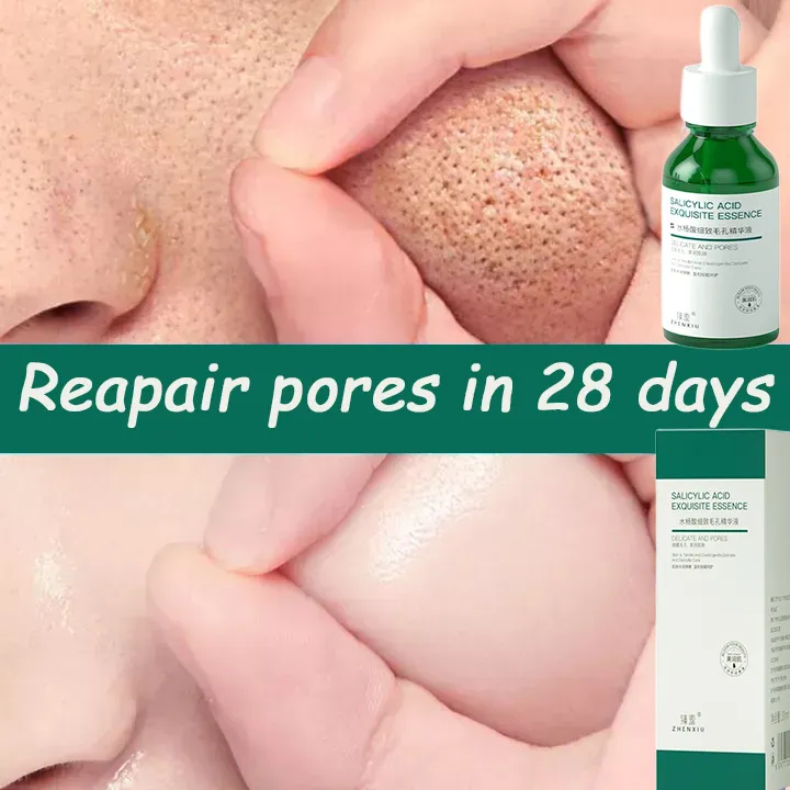 Salicylic Acid Pore Contraction Essence Moisturizing Hydrating Repair Remove Blackhead Acne Freckle Removal Hyaluronic Acid Facial Essence Pore Minimization Serum Pore Contraction
